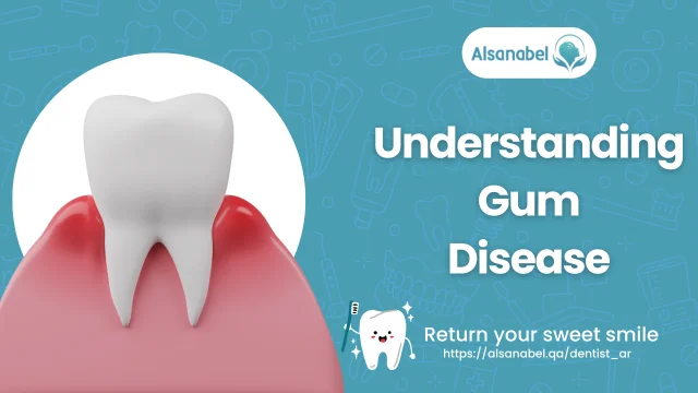 Gum Disease Treatment Qatar: Options and Clinics 2024 - Al-Sanabel Dentist