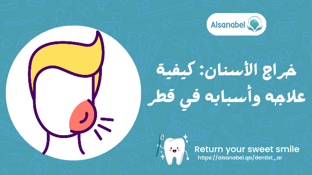 خراج الأسنان