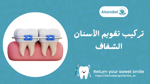 تقويم الأسنان الشفاف
