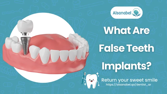 False Teeth Implants