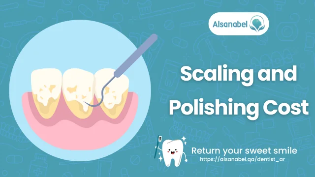 Teeth Scaling and Polishing