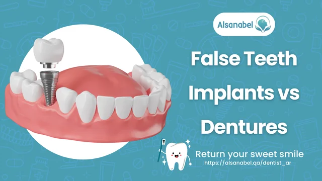 False Teeth Implants