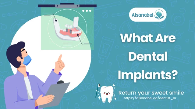 Dental Implants