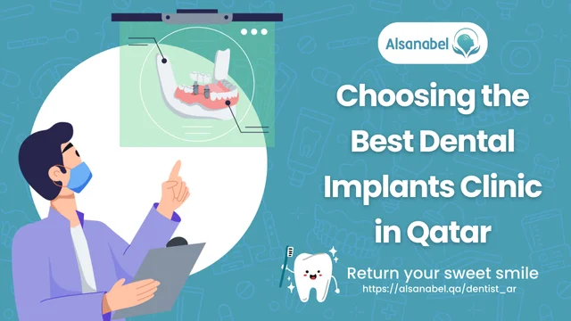Dental Implants