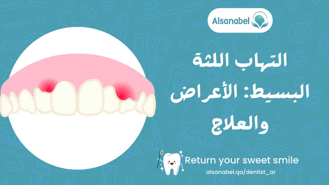 التهاب اللثة البسيط