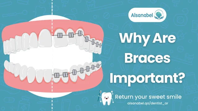 Dental Braces in Qatar