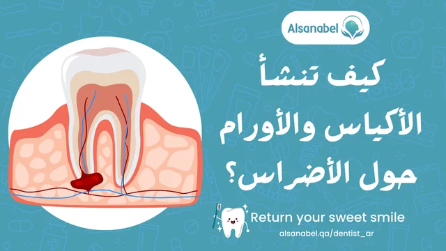 أكياس أو أورام حول أضراس العقل