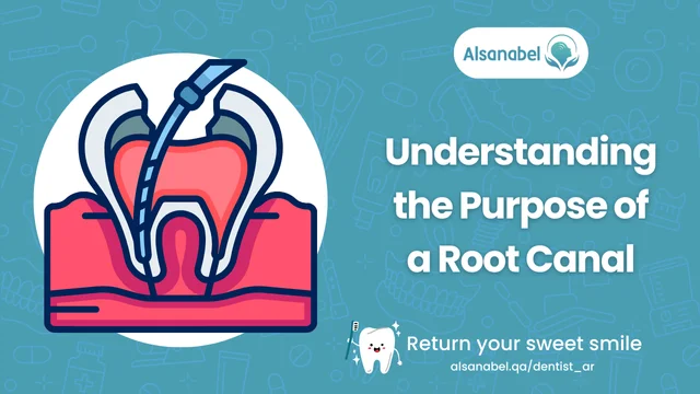 Root Canal
