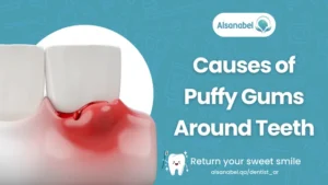 Puffy Gum Around Tooth