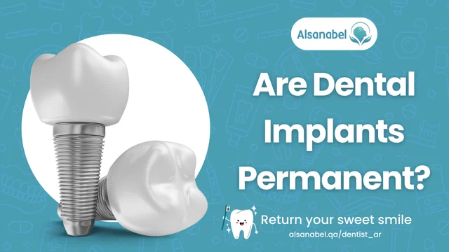 are dental implants permanent