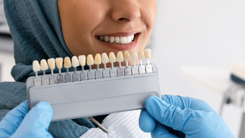 فينير الأسنان: أنواعه ومميزاته وكيفية تركيبه - مركز السنابل للأسنان