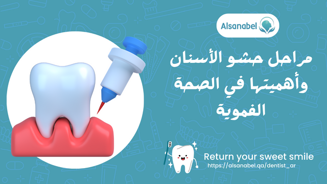 مراحل حشو الاسنان واهميتها في الصحة الفموية