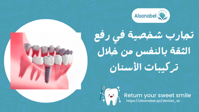 تجارب شخصية في رفع الثقة بالنفس من خلال تركيبات الأسنان