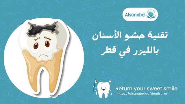 تقنية حشو الأسنان بالليزر في قطر