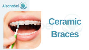 Dental Braces