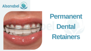 Dental Retainers