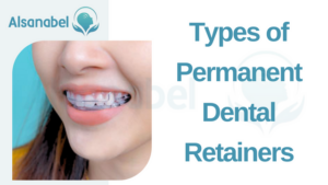 permanent dental retainer