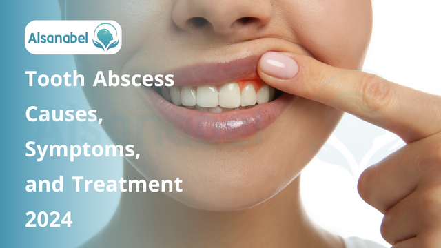 Tooth Abscess