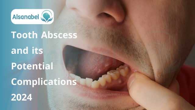 Tooth Abscess