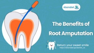 Root Amputation