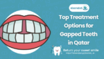 Gapped Teeth