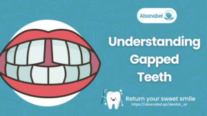 Gapped Teeth