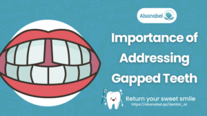 Gapped Teeth