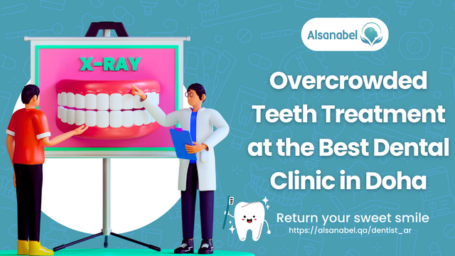 Best Dental Clinic in Doha