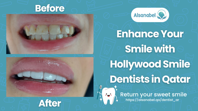 Hollywood Smile