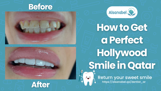 Hollywood Smile in Qatar