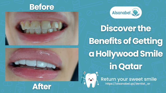 Hollywood Smile in Qatar