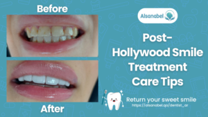 Hollywood Smile in Qatar