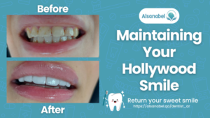 Hollywood Smile