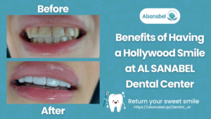 Hollywood Smile in Qatar